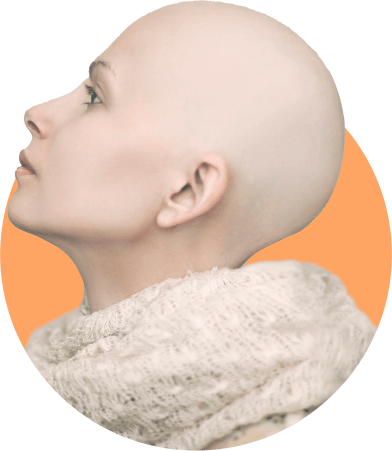 Mulher Careca Mulher Careca